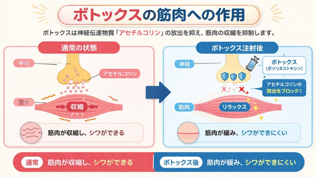 名古屋駅（名駅）エリアの美容皮膚科・形成外科におけるボトックス治療の作用機序図。神経からのアセチルコリン放出による筋肉の収縮（ボトックス前）と、投与によってアセチルコリンの放出がブロックされ筋肉が弛緩する状態（ボトックス後）を比較解説しています。