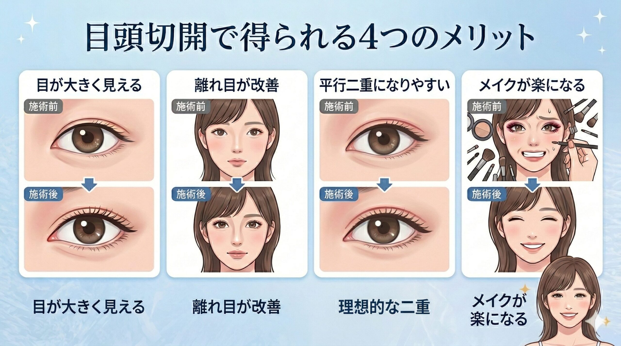 蒙古襞による目元の変化 Before/After比較図 ベルヴィアクリニック名古屋