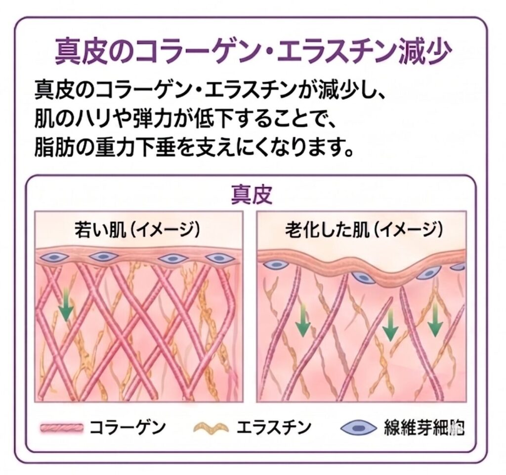 名古屋駅(名駅)の美容皮膚科Belle Via Clinicによる真皮層のエイジング解説。加齢に伴うコラーゲン・エラスチンの減少と、線維芽細胞の変化による肌のハリ・弾力低下のメカニズムを示す比較イラスト。