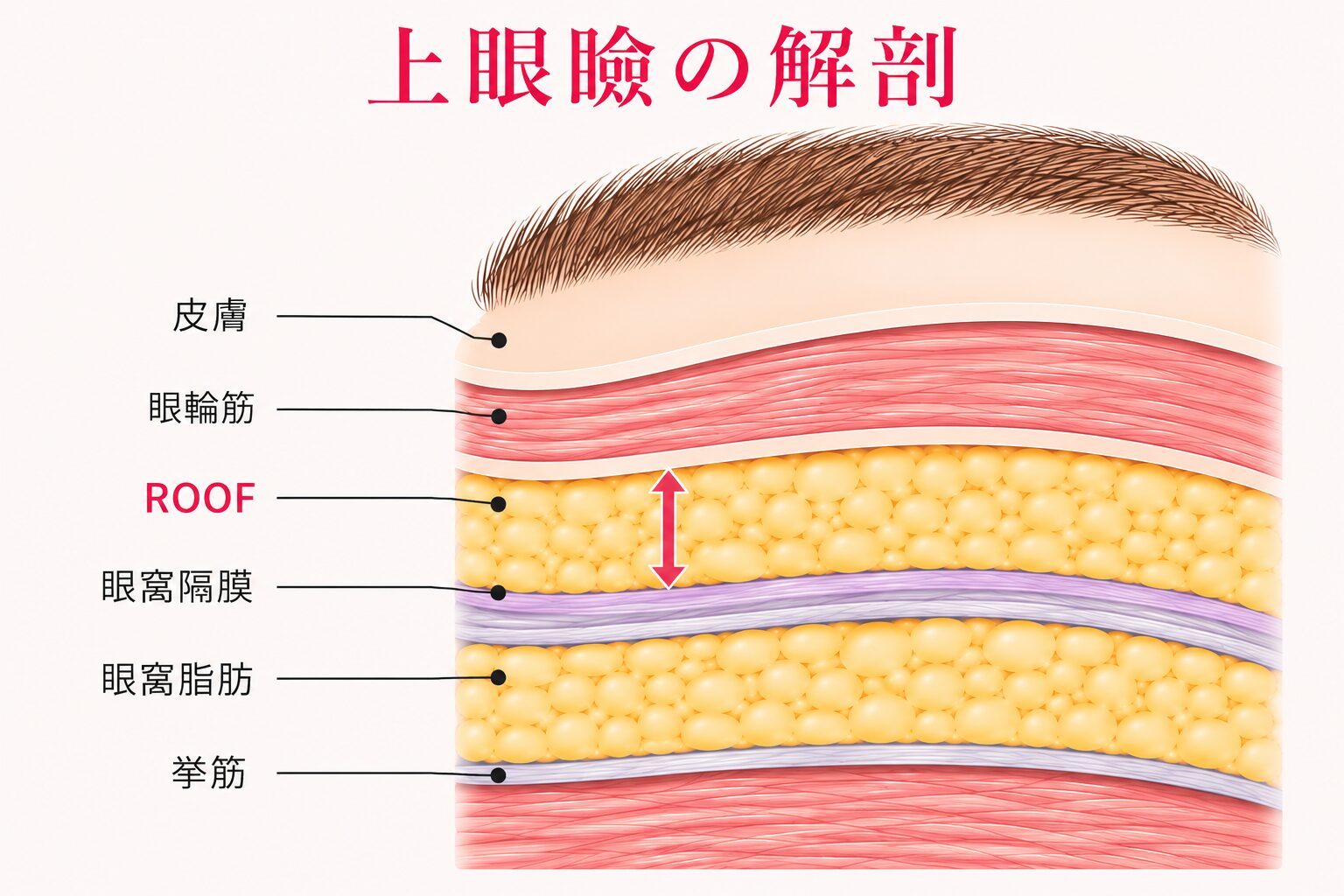 まぶたの解剖 眼輪筋・ROOF・眼窩脂肪の位置関係 ベルヴィアクリニック名古屋