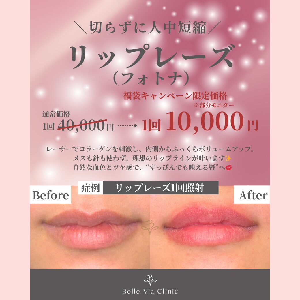 1月】福袋キャンペーン！リップレーズ（フォトナ）すっぴんでも映える 