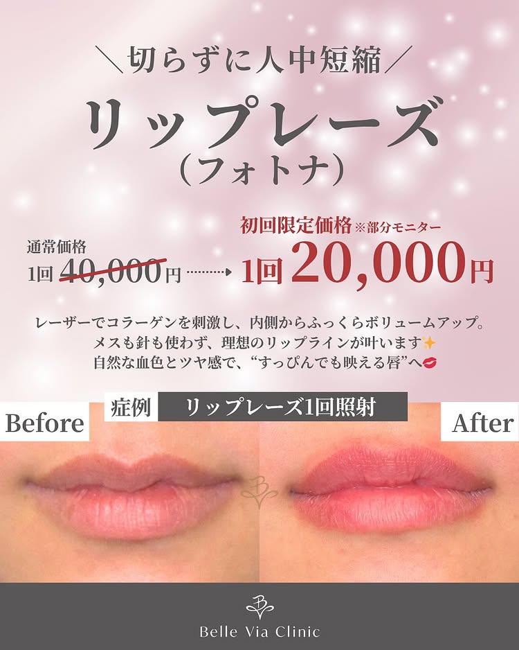 【11月】リップレーズ（フォトナ）すっぴんでも映える、うるツヤリップ