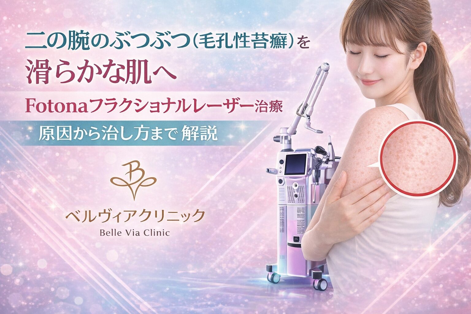 二の腕のぶつぶつ（毛孔性苔癬）を滑らかな肌へ