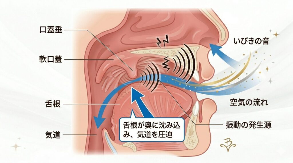 名古屋のいびき治療専門家が解説するいびきのメカニズム図解。軟口蓋や口蓋垂の振動、舌根沈下による気道の圧迫と空気の流れを視覚化したイラスト。